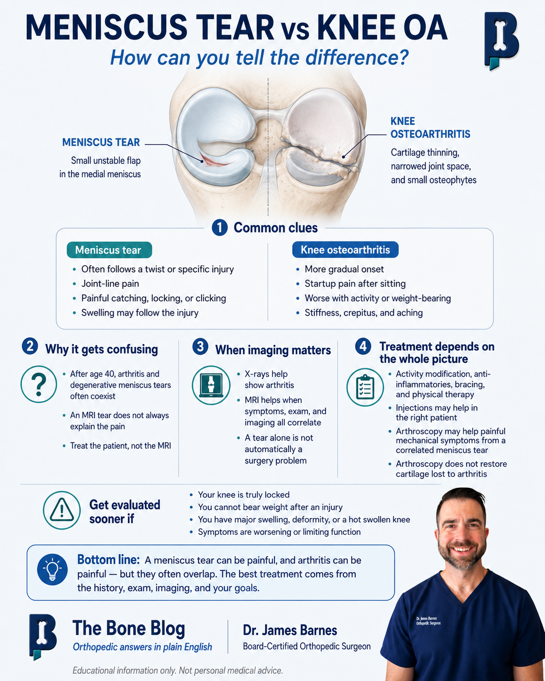 Infographic comparing meniscus tear and knee osteoarthritis: common clues for each, when imaging matters, and when to get evaluated sooner.