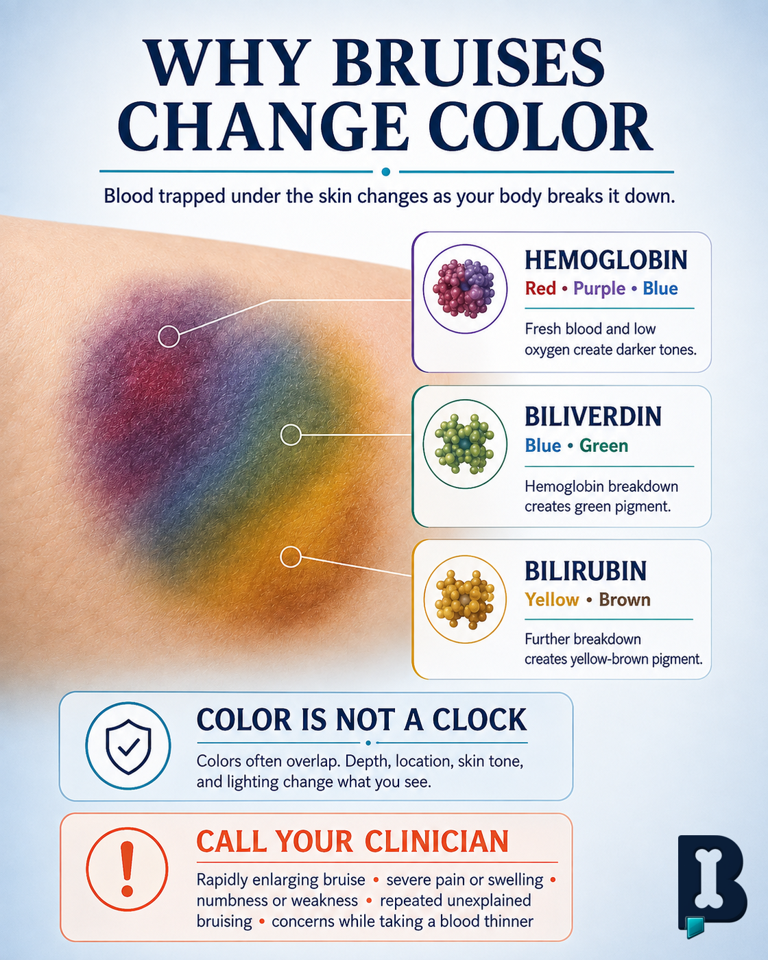 Infographic: why bruises change color, from hemoglobin to biliverdin to bilirubin, and when to call your clinician.