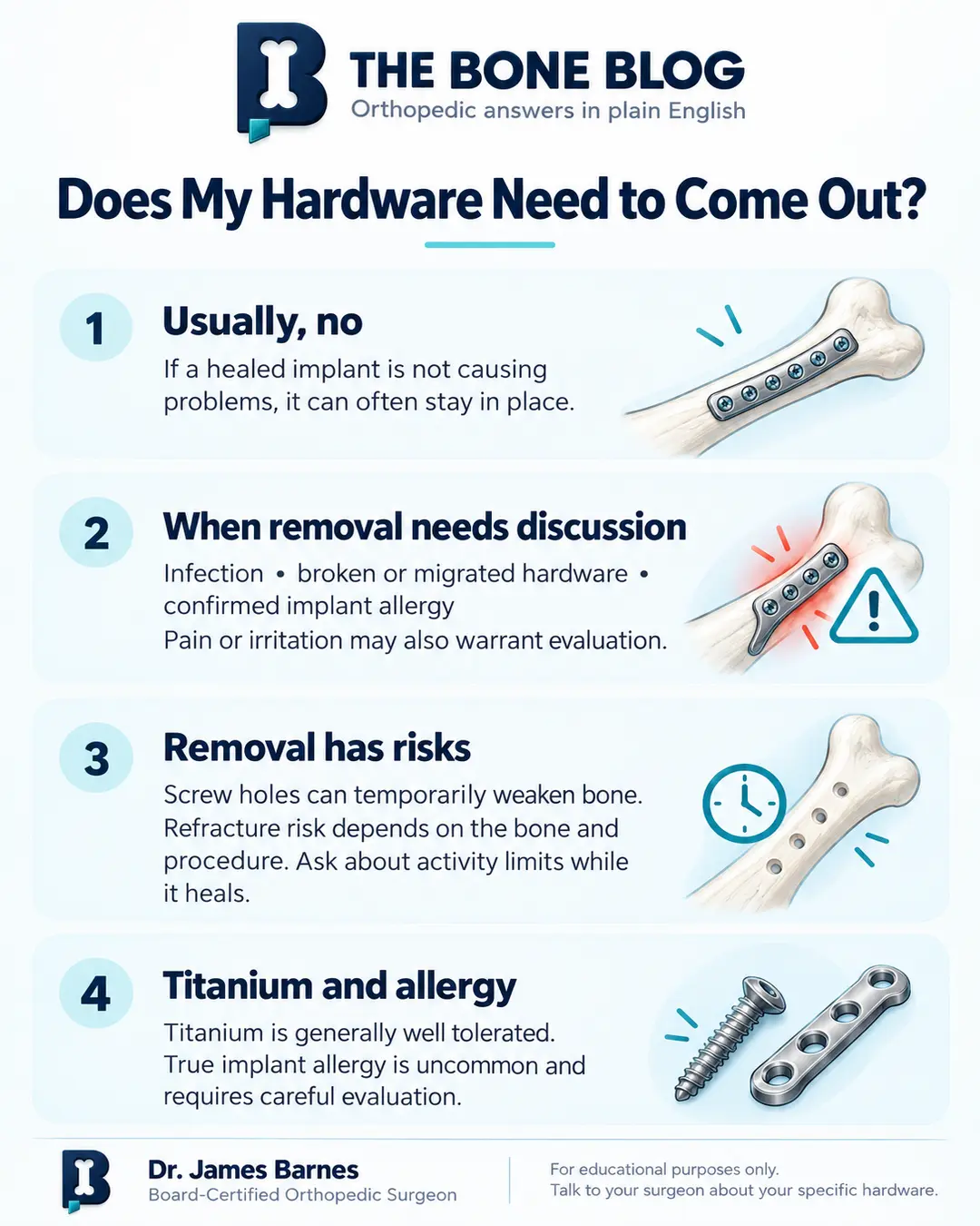 Four-panel infographic explaining that comfortable hardware may stay, reasons to discuss removal, temporary bone weakness after removal, and uncommon implant allergy.
